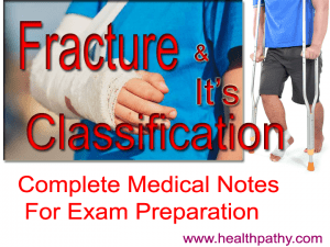 Classification of Fracture