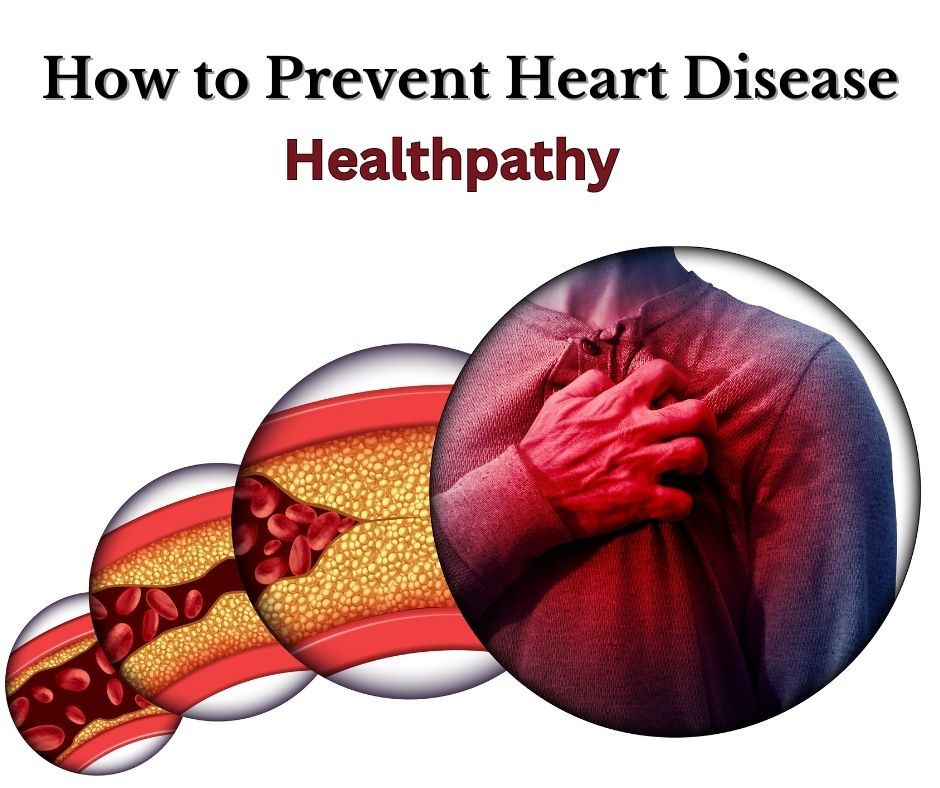 How-to-Prevent-Heart-Disease