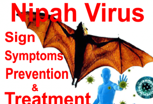 Nipah virus sign symptoms and treatment