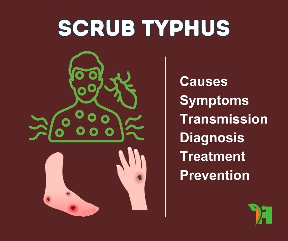 Scrub typhus