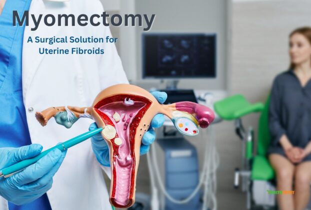 Myomectomy: A Surgical Solution for Uterine Fibroids